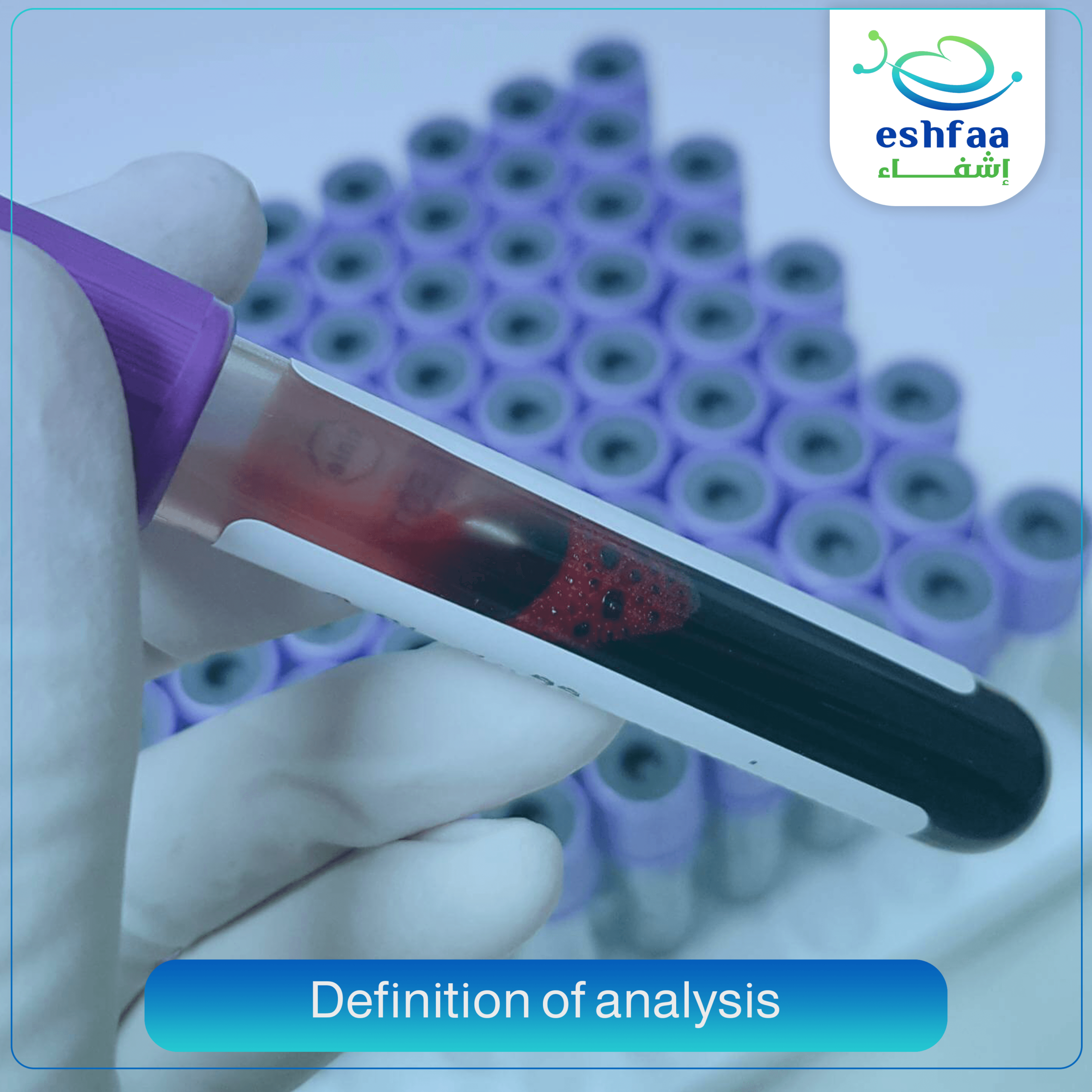 تحليل الهيموجلوبين hemoglobin تحليل