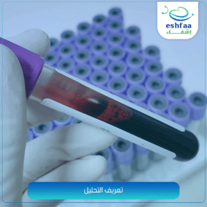 تحليل الهيموجلوبين hemoglobin تحليل