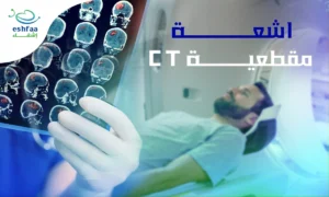 اشعة مقطعية ct