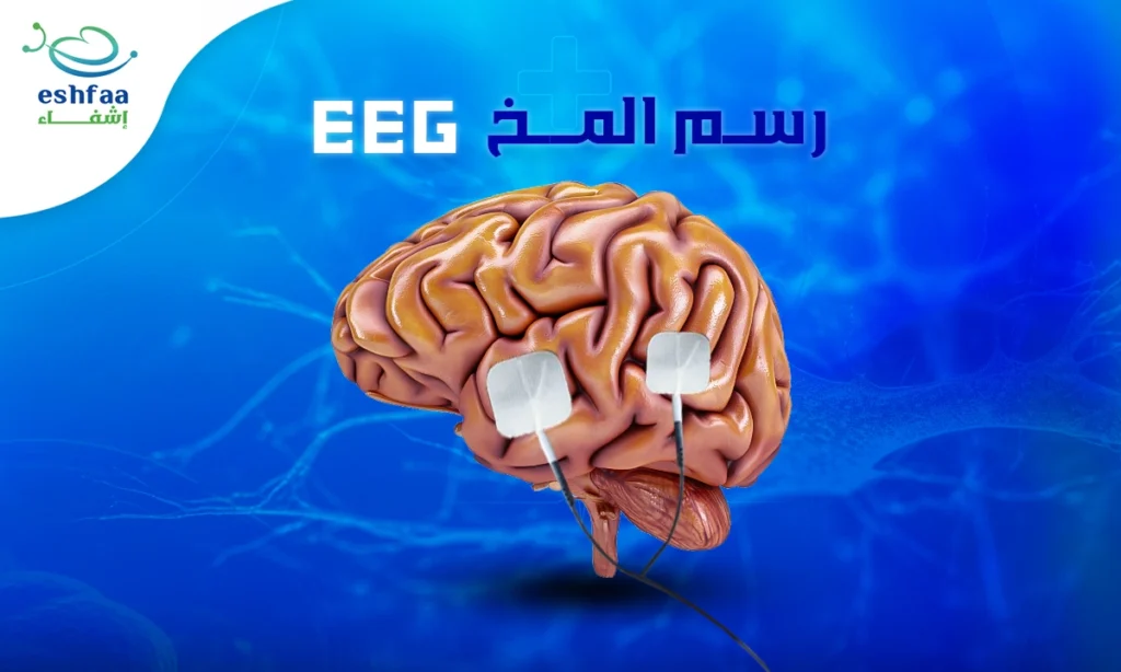 رسم المخ (EEG)